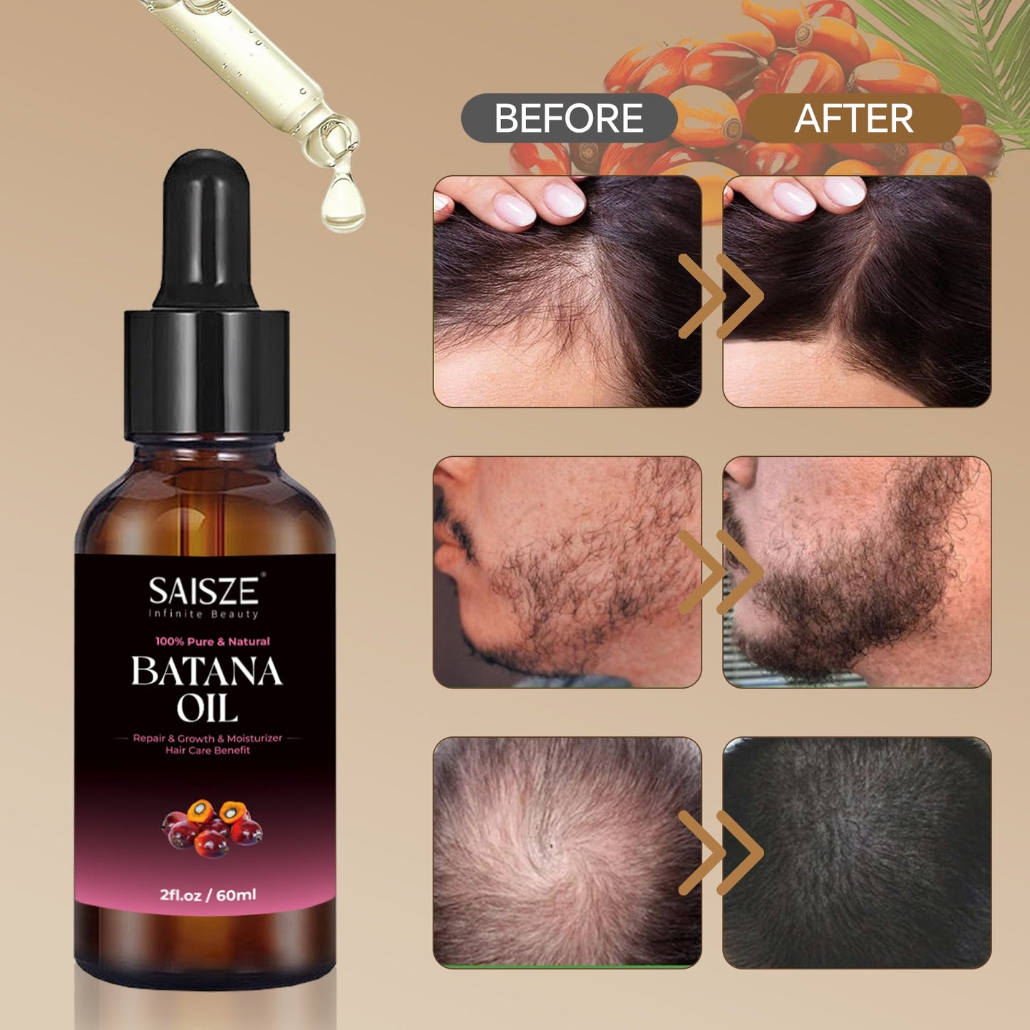 Huile essentielle de Batana pour le soin des cheveux, 100 % pure et naturelle, 57 ml