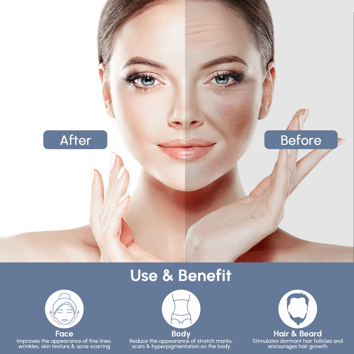 Stylo à aiguilles réglables en titane pour micro-aiguilles Derma