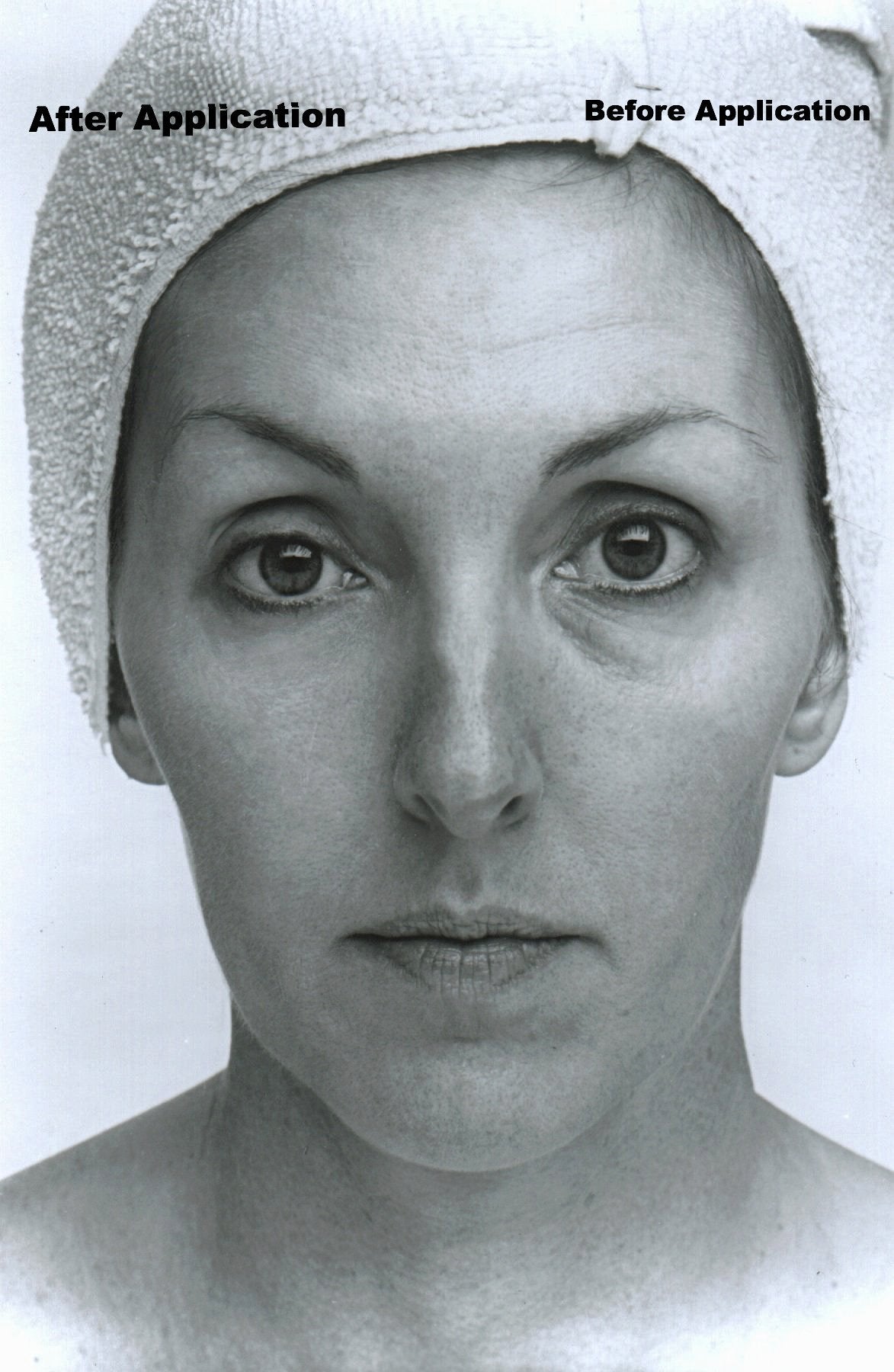 Soin du visage liftant au collagène avec crème anti-rides rapide