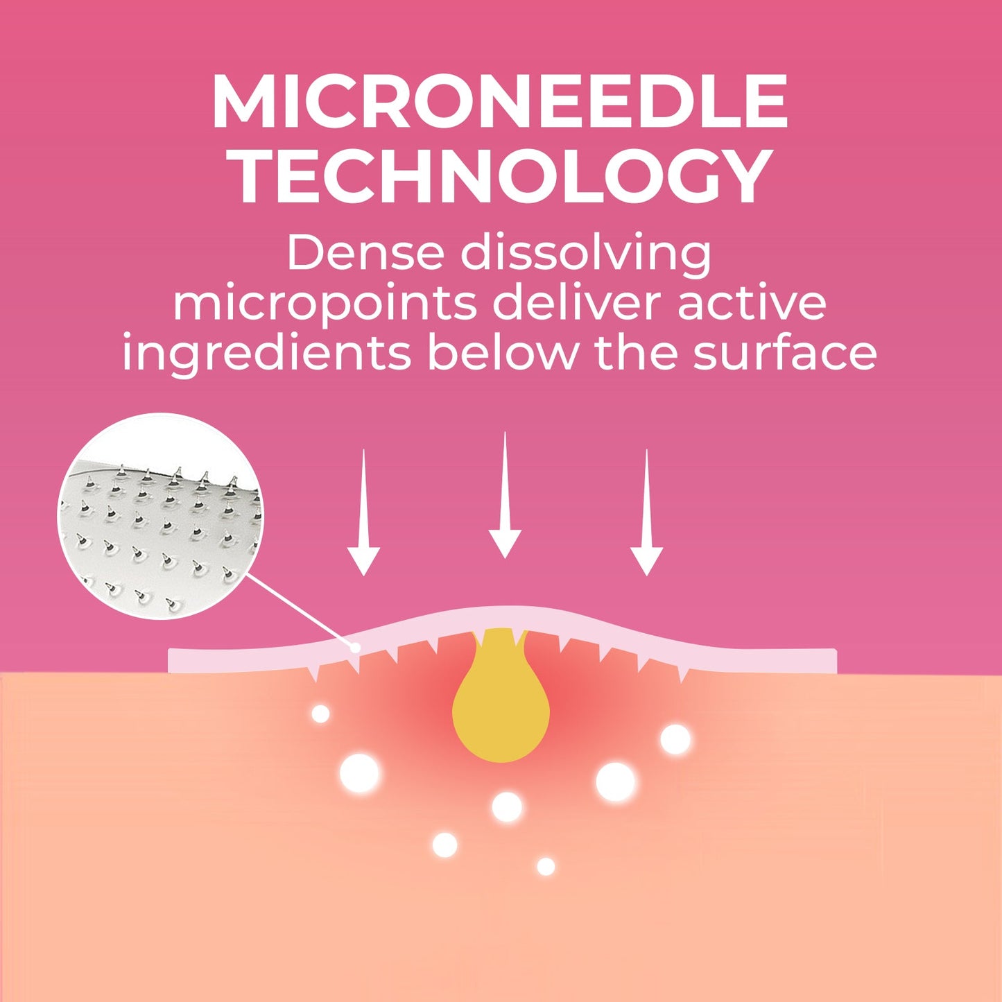 Parches hidrocoloides invisibles para el acné Microdart Pimple Patch para todos