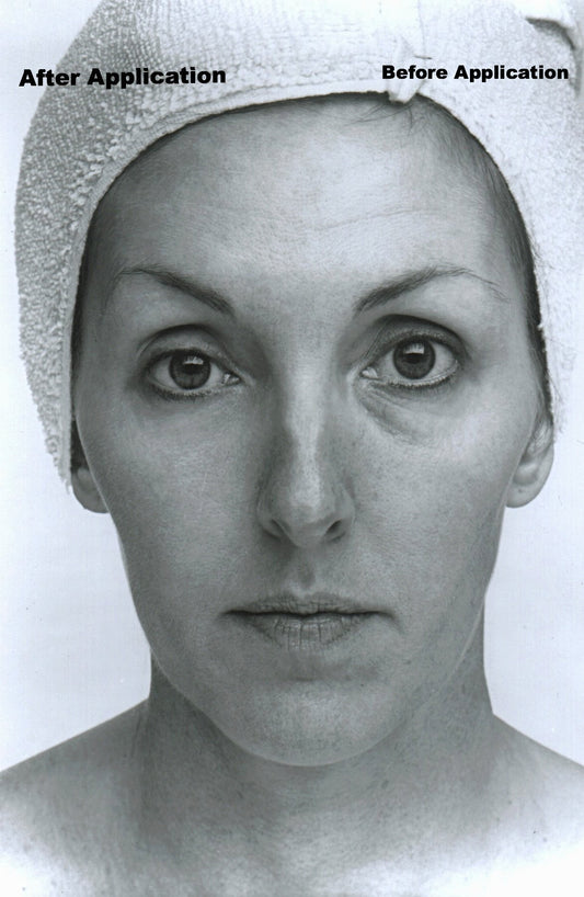 Facial lifting de colágeno con crema de rápida eliminación de arrugas